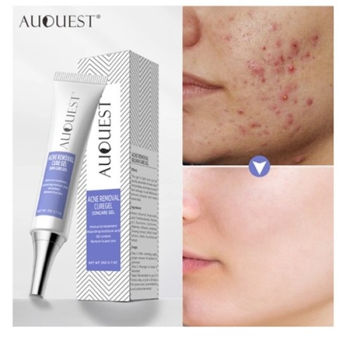Auquest Acne Removal Cure Gel